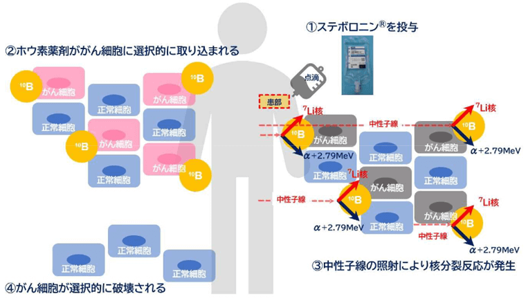 BNCTの治療イメージ